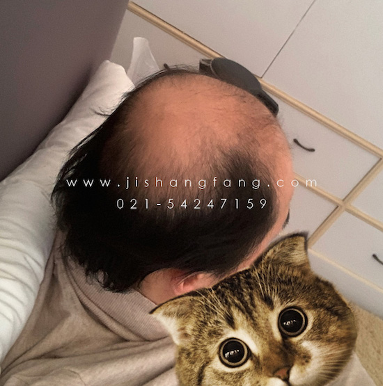 ҂J(rn)   oゃõw(yn)ͷ(w)2